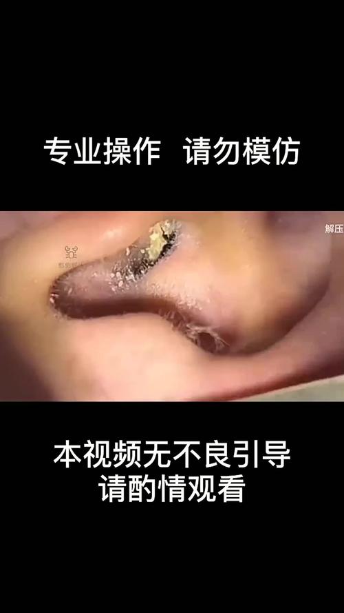 吃了耳屎会怎么样
