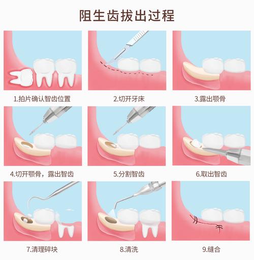 不拔智齿会怎么样