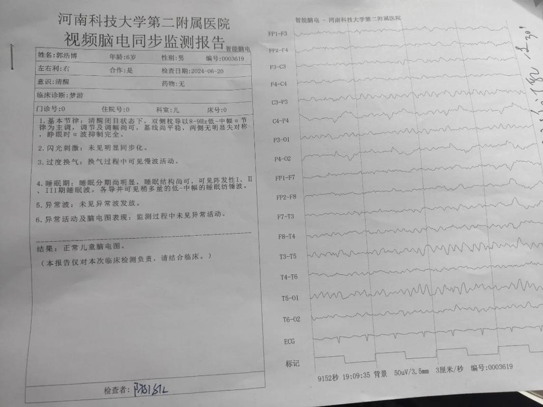 脑电波检查多少钱