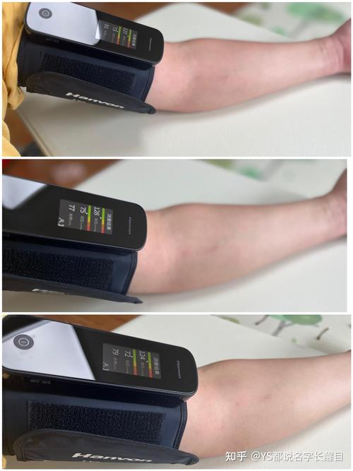 电子血压计多少钱一台