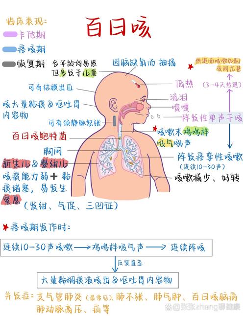 日本百日咳持续蔓延 今年已超5万例