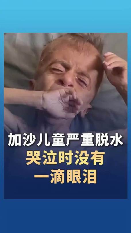 加沙儿童严重脱水 哭时没有一滴眼泪