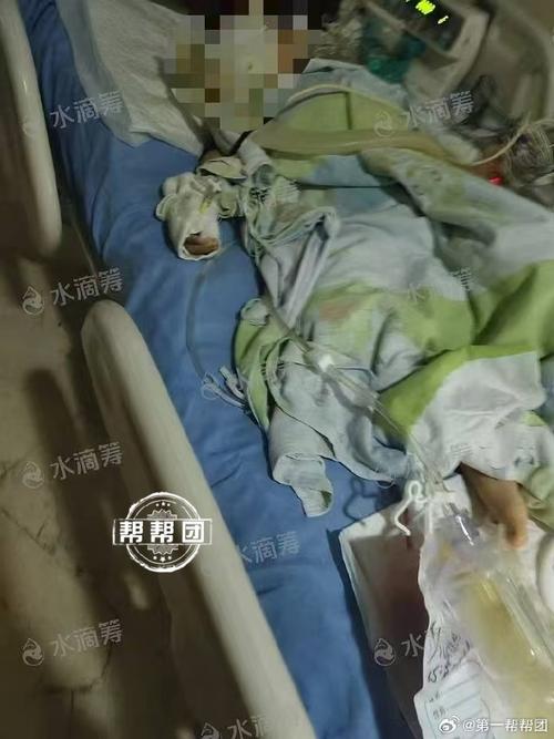 男生被邻居撞成重伤 一年后不治身亡