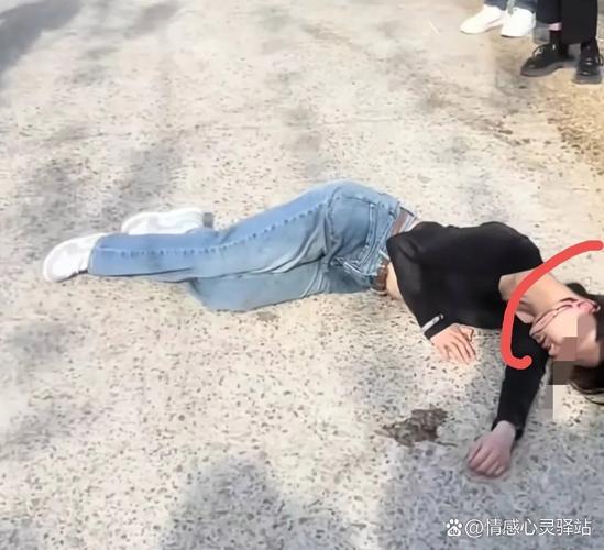 贵州女游客被猴子踢倒骨折