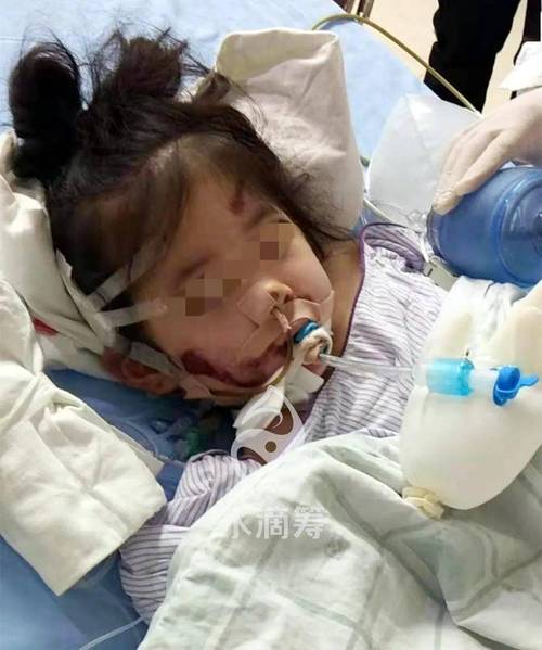 荣成车祸进ICU小孩不幸去世