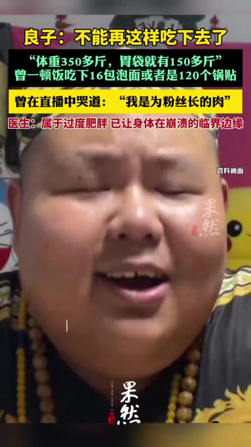 网红良子体重350多斤 胃袋占150多斤