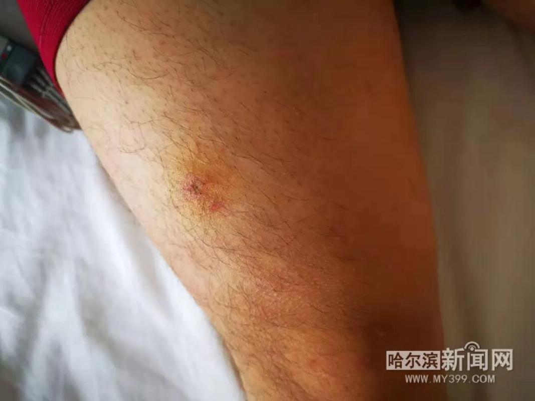 8旬老人捅马蜂窝被蛰不幸去世