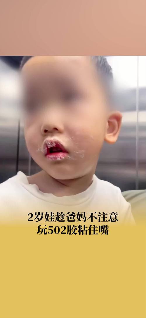 山东一幼儿园用胶带封孩子嘴?假