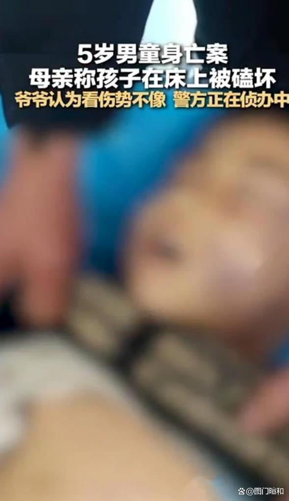 5岁男童撞倒1岁半幼童 警方介入