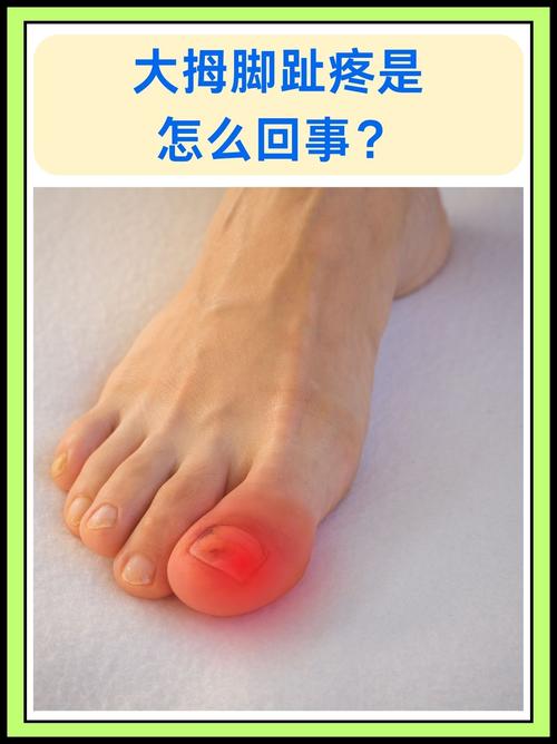 小伙豪饮火锅汤后痛风发作无法行走