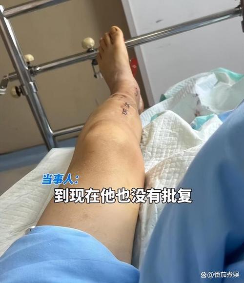 共享单车骑行中突然被锁致多人摔伤