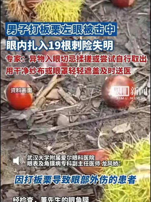 男子打板栗左眼扎入19根刺险失明