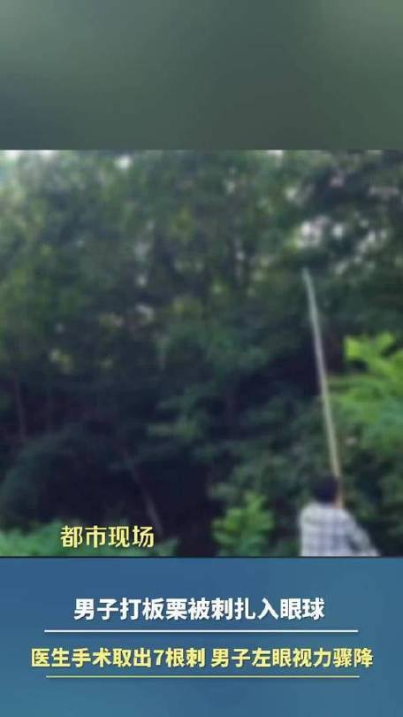 男子打板栗左眼扎入19根刺险失明