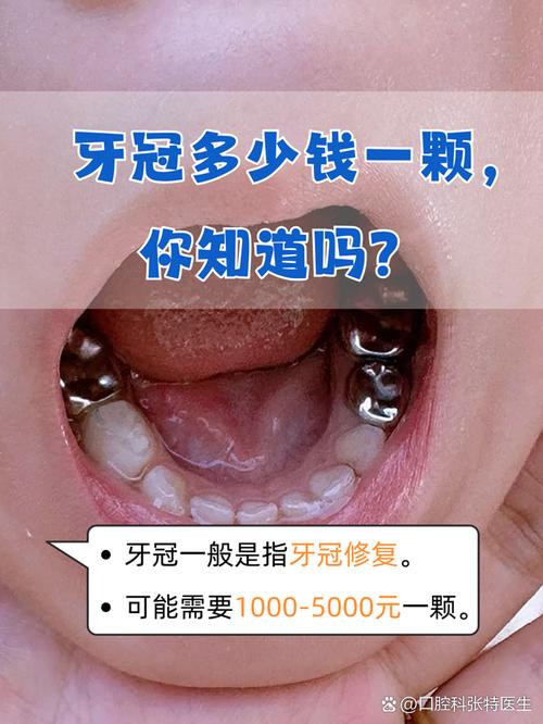牙齿文身风靡齿科:牙冠刻印“发财”