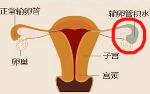 试管婴儿患肾病 父母要求医院担全责