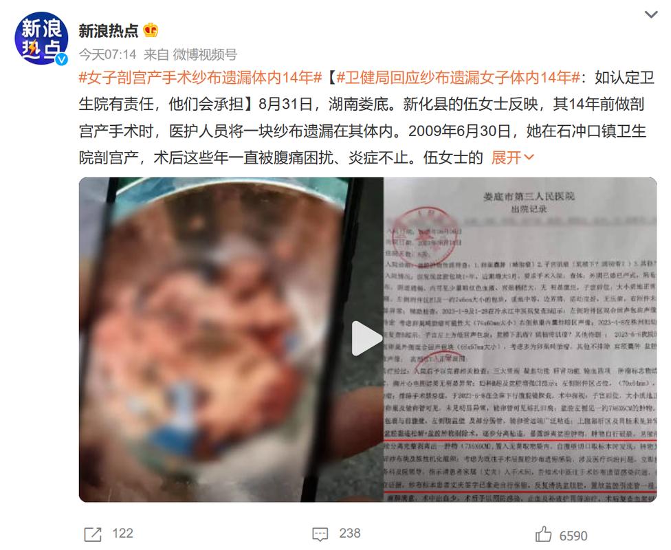 女子术后20天发现体内留纱布已发臭