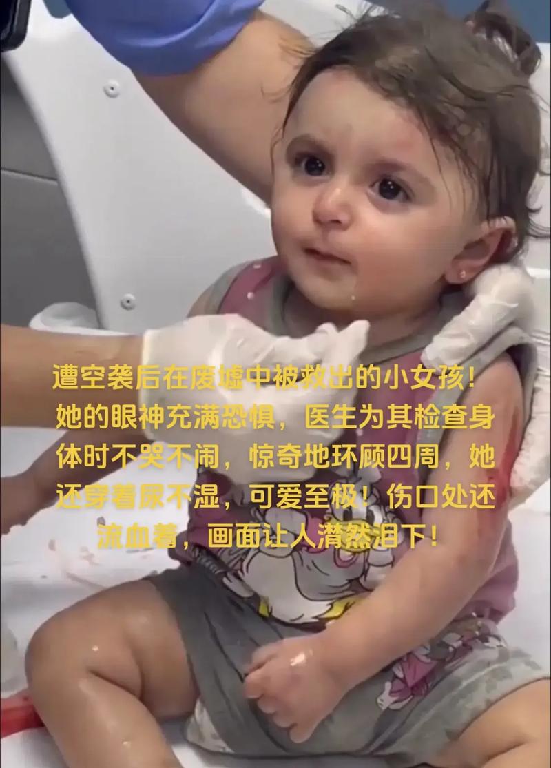 巴勒斯坦女孩废墟中被救出全身颤抖