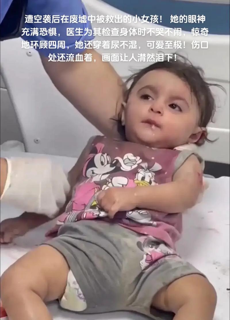 巴勒斯坦女孩废墟中被救出全身颤抖