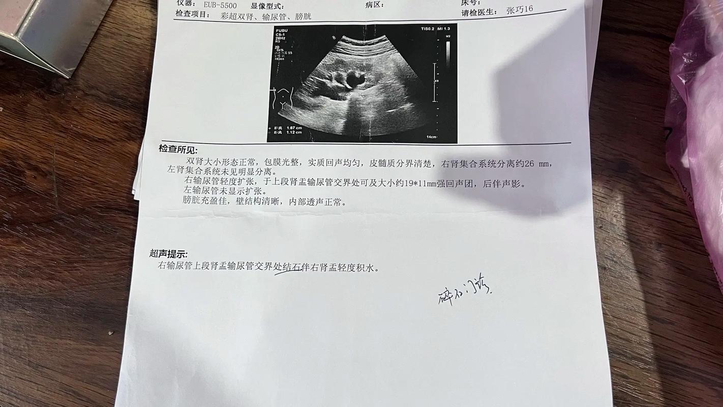 男子查出肾结石未重视拖成大麻烦