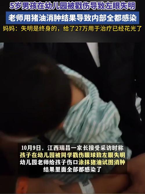 5岁男孩在幼儿园被戳伤致左眼失明