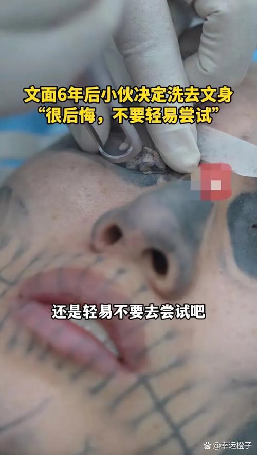 “纹面男孩”称再洗2次纹身就干净了