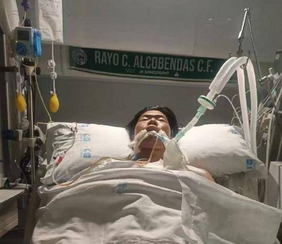 尼泊尔乙型脑炎已致31人死亡