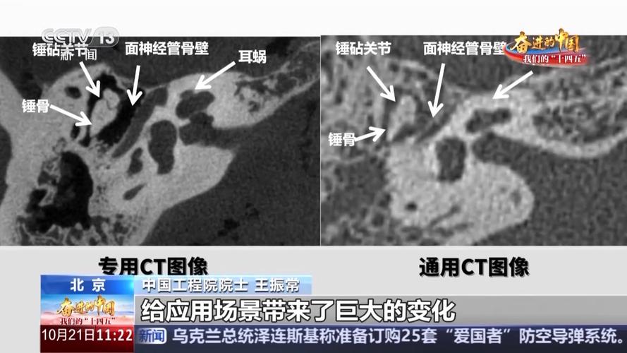 国产医疗装备“利器”层出