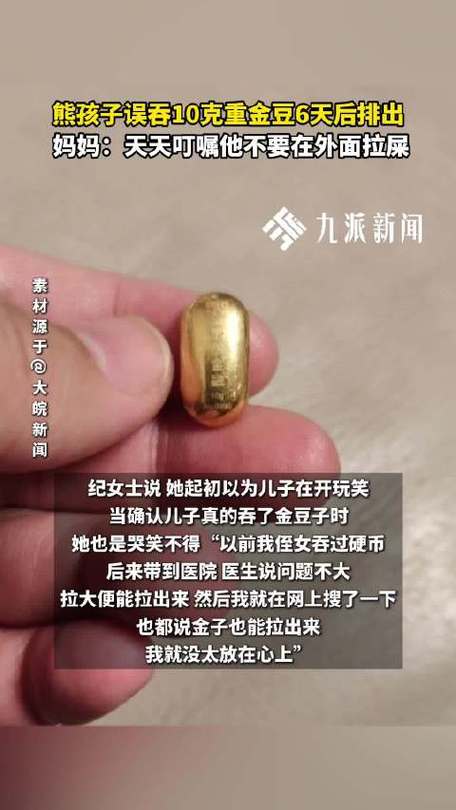熊孩子误吞10克金豆6天后排出