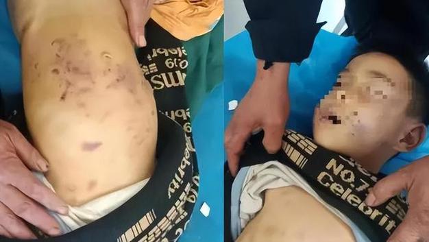 巴西9岁男孩捅死母亲