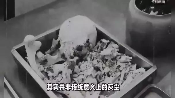老人火化后骨灰里多出四个钢钉