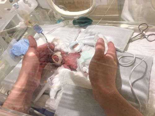 女儿养了仨月 出院记录显示“男婴”
