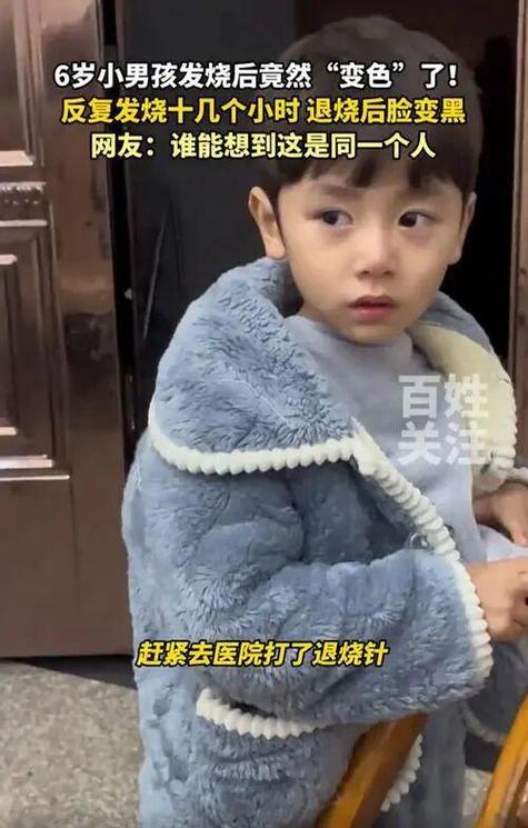 男孩发烧十几个小时 退烧后脸变黑